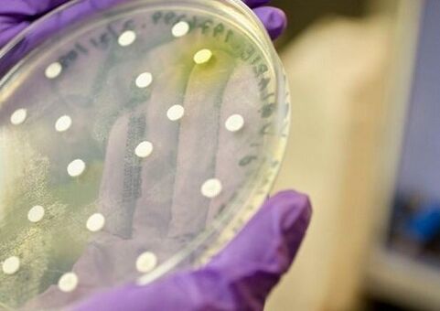Βακτηριακή καλλιέργεια για τη διάγνωση της προστατίτιδας